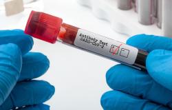 Vaccini: test sierologici per verificarne l'efficacia