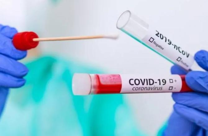 Covid Coronavirus